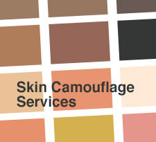 Skin Camouflage Services